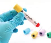 A Hidden Cause of Vascular Disease