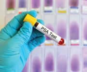 Screening Recommendations