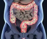 What are Prebiotics?