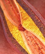 Fish Oil Reduces Death Rates