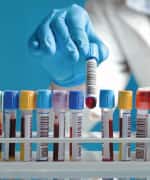 blood tests