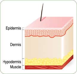 Skin Regenerative Effects