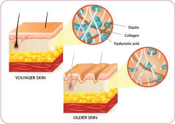 Hyaluronic Acid: The Skin’s Internal Moisturizer