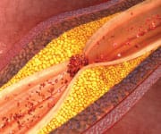 Cardioprotective Effects