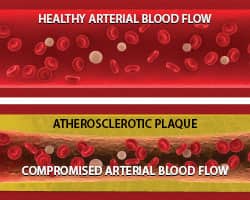 French Maritime Pine Bark Extract Blocks Plaque