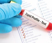 Lipid Profile Test