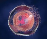 Cell undergoing Apoptosis. Apoptosis is often referred to as programmed cell death.