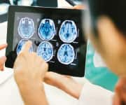 Human Study Shows that Lithium Preserves Cognition