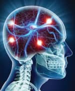 IMAGE DESCRIPTION HERE