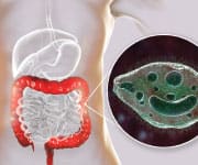 Image of intestinal cells