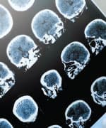 image of brain scan
