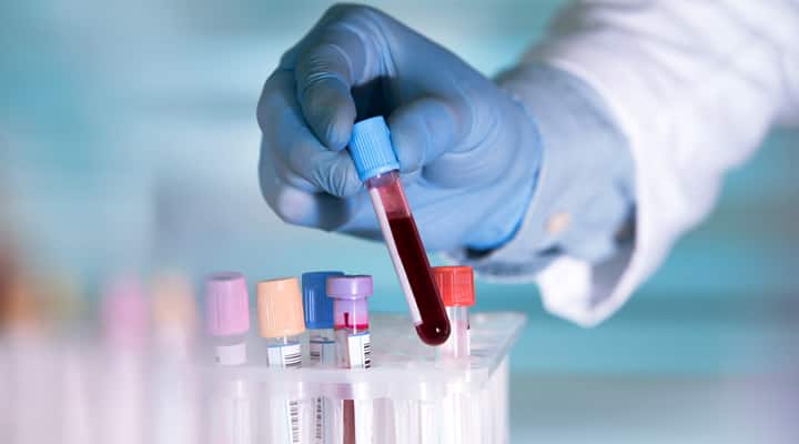 Lab tech handling blood vials for statin drug levels