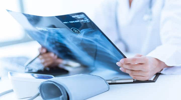 Doctor examining patient’s x ray for nutrition deficiencies