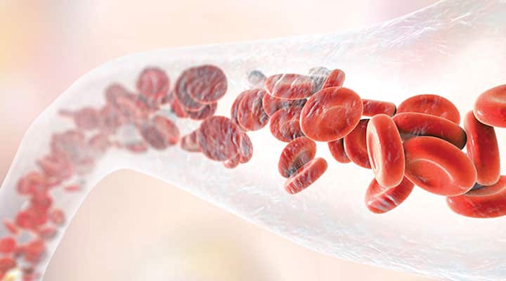 Blood vessel that has clear flow with reduced plaque from quercetin supplementation