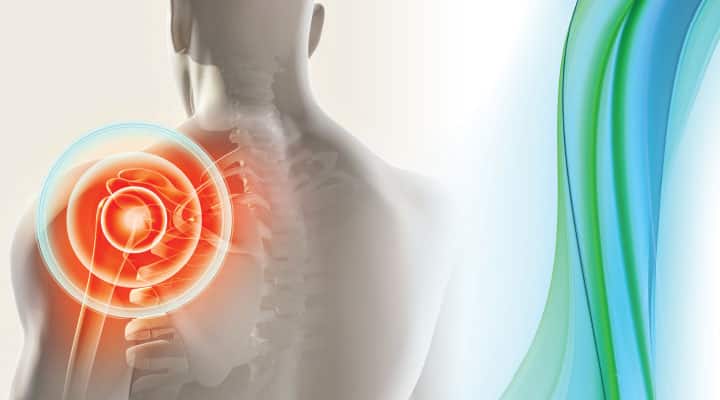 X-ray colored red to show joint discomfort and inflammation