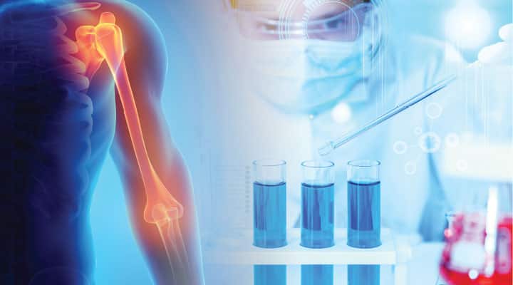 Example of bone strengthening from PQQ in man