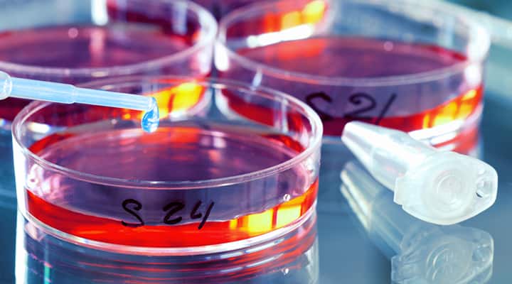 Lab testing treatments for endometriosis in petri-dishes