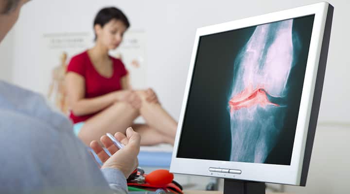 Doctor speaking to woman on her lupus cause inflammation