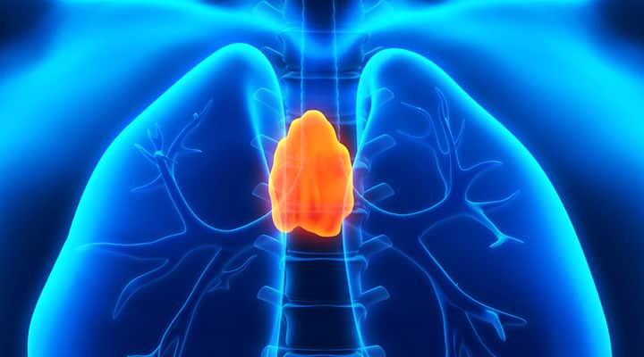 Severe case of myasthenia gravis affecting surrounding respiratory muscles