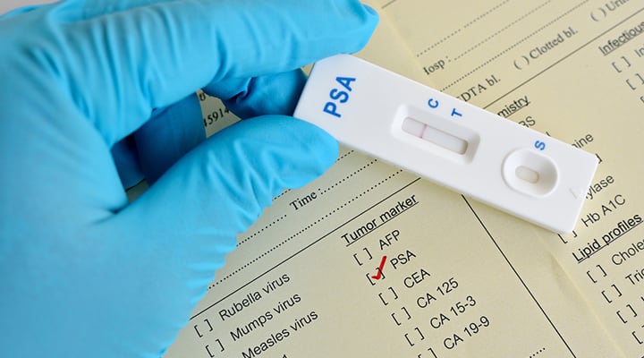 Doctor handling a digital test for prostate cancer protection and prevention