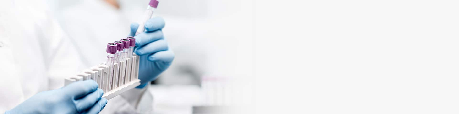 Lab Testing Services – Unlock Better Health - Life Extension