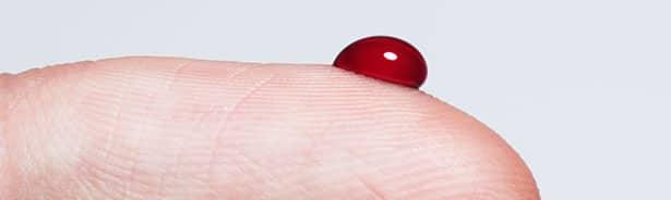 Blood drawn from finger for anemia testing