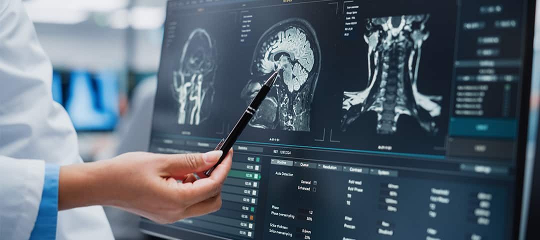 Doctor pointing at brain scans