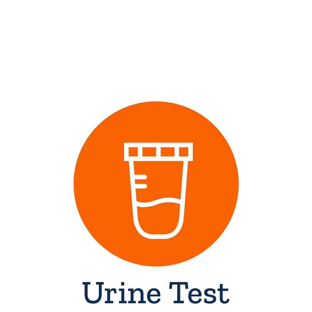 Life Extension MicroalbuminCreatinine Ratio Random Urine 41$
