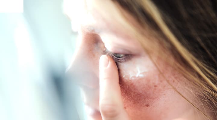 Rosacea: Triggers, Types, Diagnosis, Treatments & Nutritional Hacks