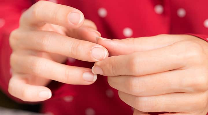 Close up of womans damaged nail ridges