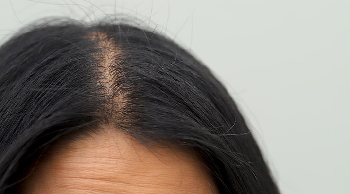 Your diet affects hair growth.