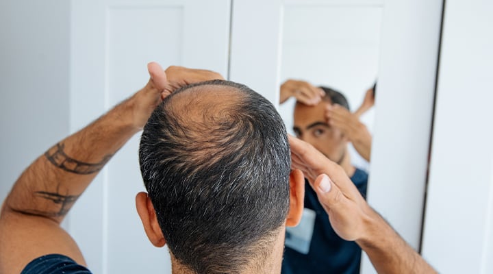 Vitamin intake can affect hair growth.