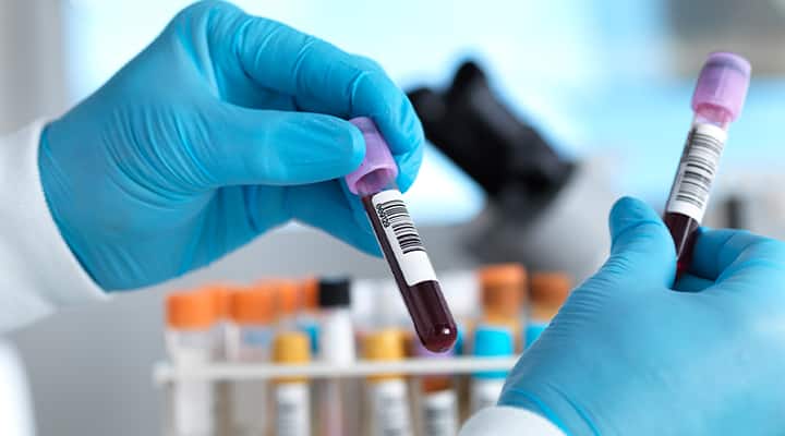 GLP-1 blood tests can help assess your overall health.