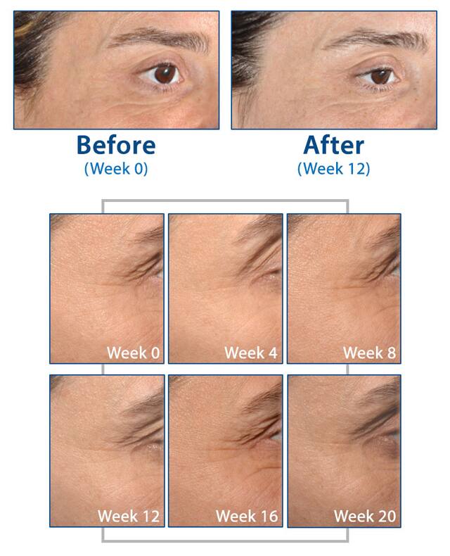 Skin Restoring Ceramides, 30 capsules | Life Extension