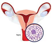 Diagram of a womens uterus