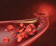 Increasing levels of Bifidobacteria decreases blood sugar