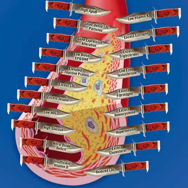 20 Daggers of arteria disease