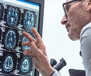 Chance of dementia increases with metabolic syndrome