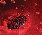 Vitamin K promotes healthy clotting