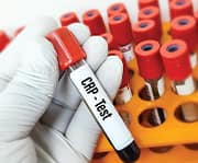 Life-saving treatments face delays