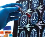 Vitamin B12 defeciency can lead to neurological issues