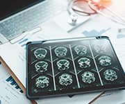 Low dose oral lithium has several health benefits