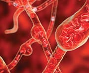 Blood vessels helped by hesperidin