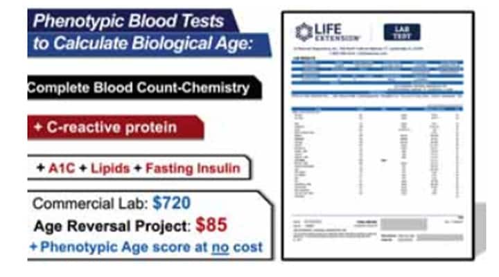 High CRP in women increases coronary heart disease 223 percent