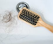 Progressive hair loss may begin in early adulthood, affecting about 30% of men by age 30 and worsening with age.