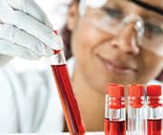 Lycopene is a carotenoid with antioxidant, anti-inflammatory, and anti-glycation properties.