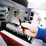 PLAC® Test Predicts Acute Cardiovascular Events