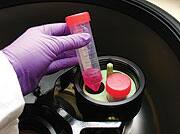 Master Regulators of Joint Repair