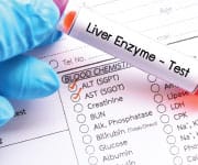 Liver Enzyme Test