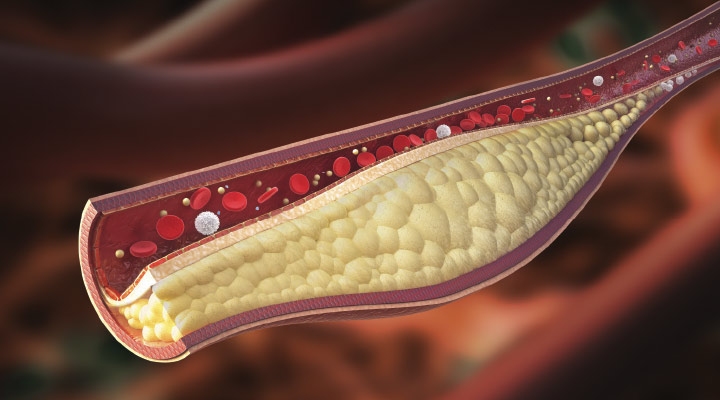 Life Extension Magazine